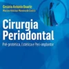Cirurgia Periodontal - Pré-protética, Estética e Peri-implantar