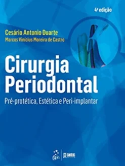 Cirurgia Periodontal - Pré-protética, Estética e Peri-implantar