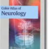 Color Atlas of Neurology