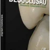 Desoclusão - Alinhamento Tridimensional e Oclusão