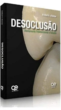 Desoclusão - Alinhamento Tridimensional e Oclusão