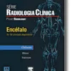 Encéfalo - Os 100 Principais Diagnósticos