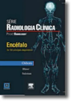 Encéfalo - Os 100 Principais Diagnósticos