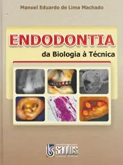 Endodontia da Biologia a Técnica