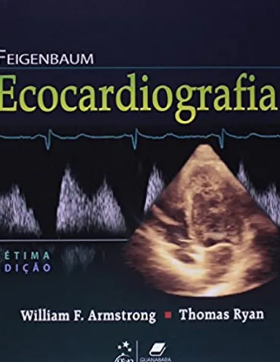 Feigenbaum Ecocardiografia