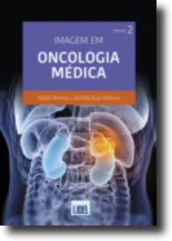 Imagem em Oncologia Médica - Volume 2