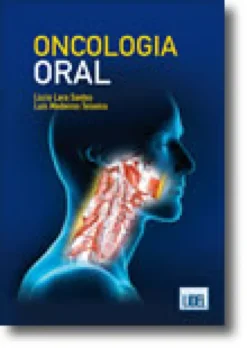 Oncologia Oral