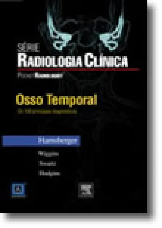 Osso Temporal - Os 100 Principais Diagnósticos