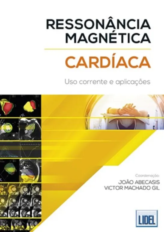 Ressonância Magnética Cardíaca