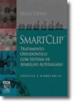 Smartclip Tratamento Ortodôntico com Sistema de Aparelho Autoligado - Conceito e Biomecânica