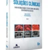 Soluções Clínicas Para Reabilitações Totais Sobre Implantes Sem Enxertos Ósseos - Vol. 2