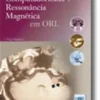 Tomografia Computadorizada e Ressonância Magnética em ORL