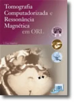 Tomografia Computadorizada e Ressonância Magnética em ORL